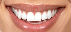 Est-ce que les mutuelles remboursent bien l’orthodontie pour les adultes ?